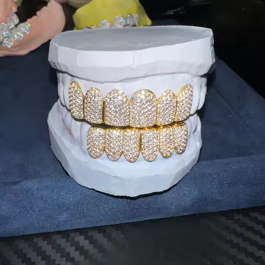"BlingBling Diamond Braces - make even your smile shine on your wedding day ✨!
