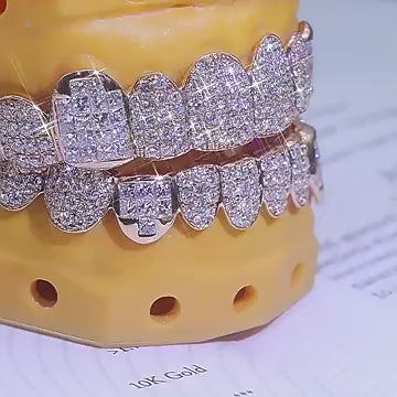 "BlingBling Diamond Braces - make even your smile shine on your wedding day ✨!